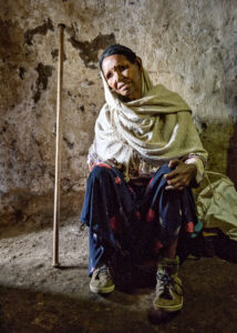 Leper, Korah, Ethiopia, Tamara Lackey, Nikon